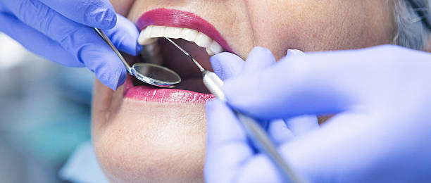 Best Emergency Wisdom Teeth Removal in Suitland, MD